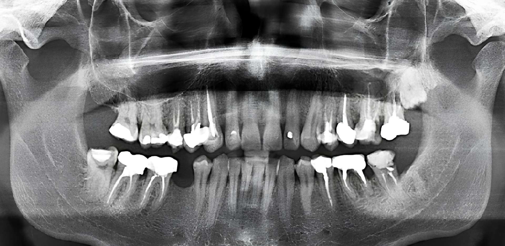radiographie