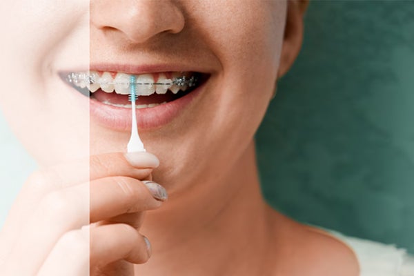 elmex ortho toothbrush